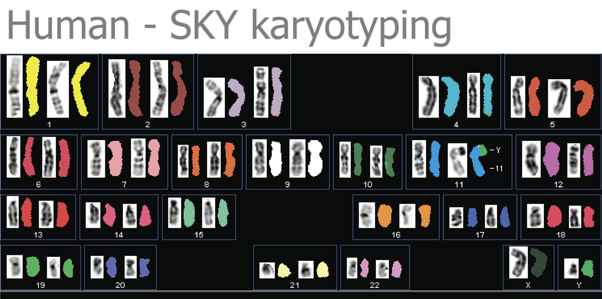 HiSKY光谱核型比对分析系统