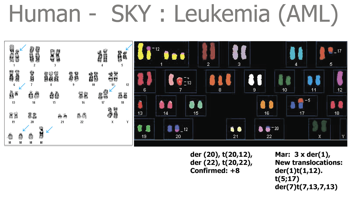 HiSKY光谱核型比对分析系统